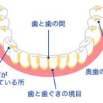 歯の仕組みを知って予防の方法を考える