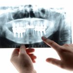 歯周病と関連のある２つの病気について