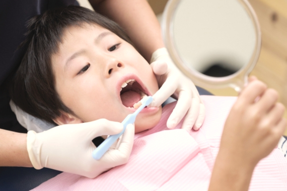子どもの歯科検診