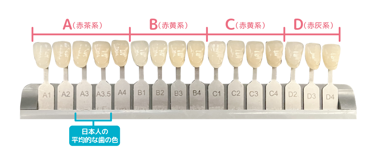 歯の色